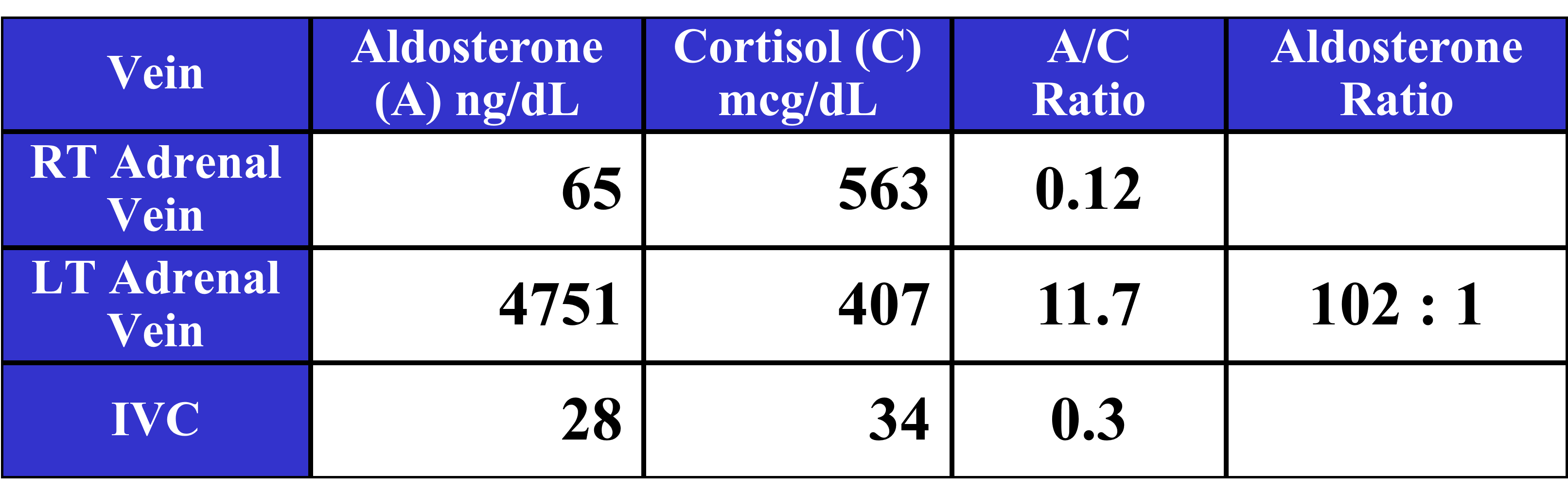 Typical results from a positive adrenal vein sampling demonstrating an aldosterone-producing adrenal tumor in the left adrenal gland. The adrenal vein sampling results need to be interpreted by an expert.