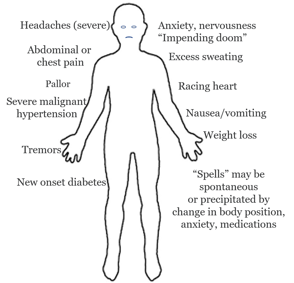 Signs and symptoms of Pheochromocytoma and Paraganglioma. The symptoms can be very variable, and some patients are asymptomatic