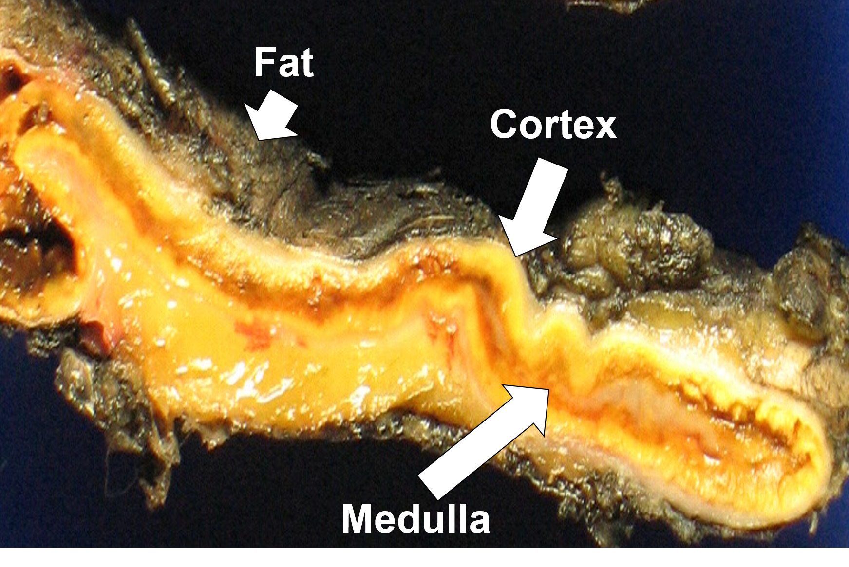 adrenal gland produces