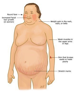 Weight Gain And Adrenal Tumors